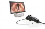 Sensor Naso-Pharyngo-Laryngoscope
